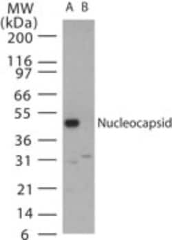 SARS Nucleocapsid Protein Antibody - BSA Free, Novus Biologicals 0.025